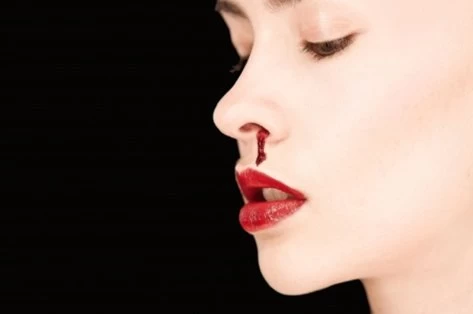 Αιμορραγία από τη μύτη: Τι πρέπει να κάνετε – Οδηγίες βήμα-βήμα